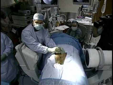 <b>Pain after interstim implant</b>. . Interstim removal recovery time